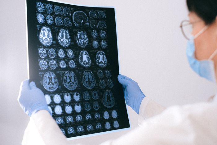 Neurology