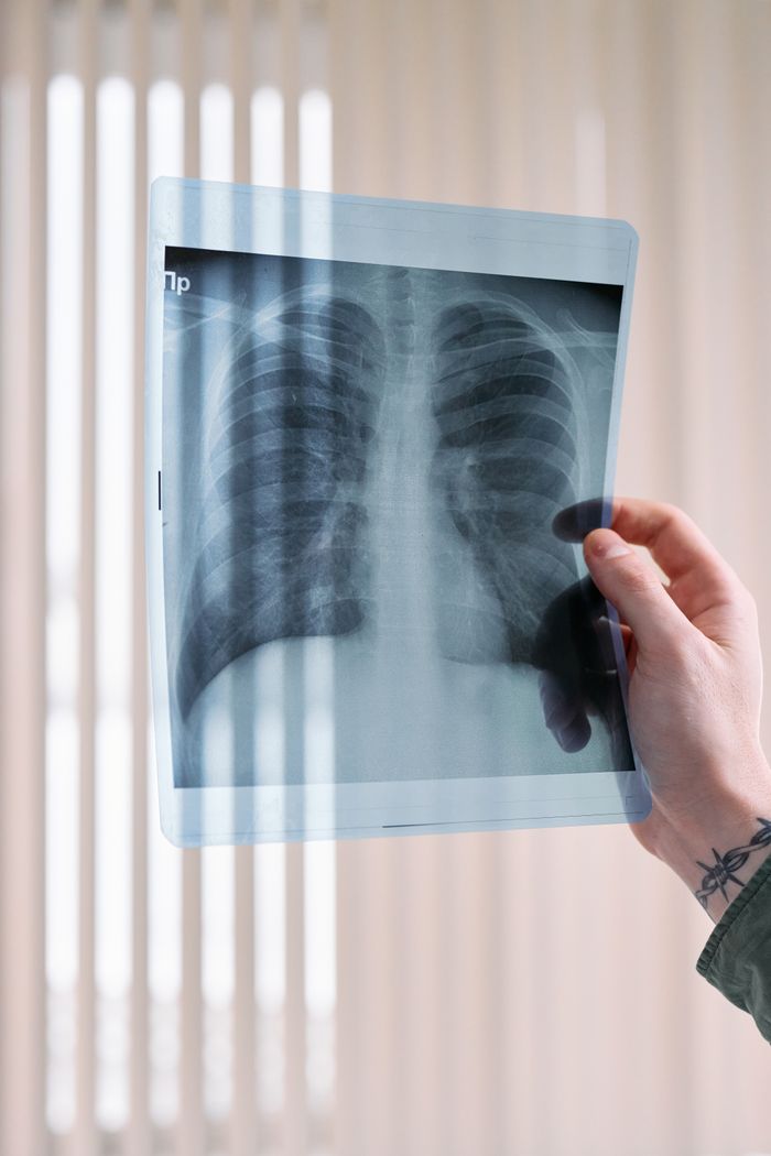 Pulmonology